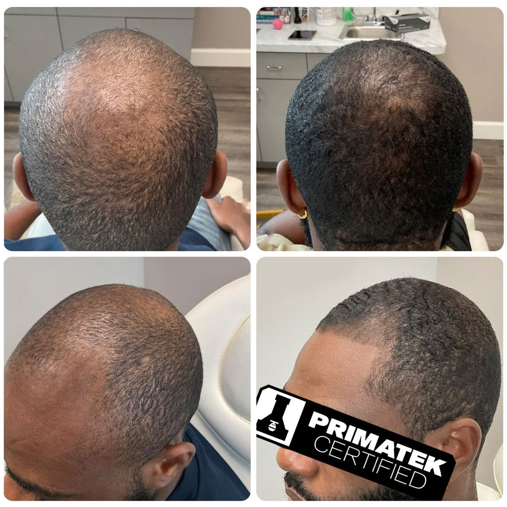 Système de Régénération Primatek Revolution™