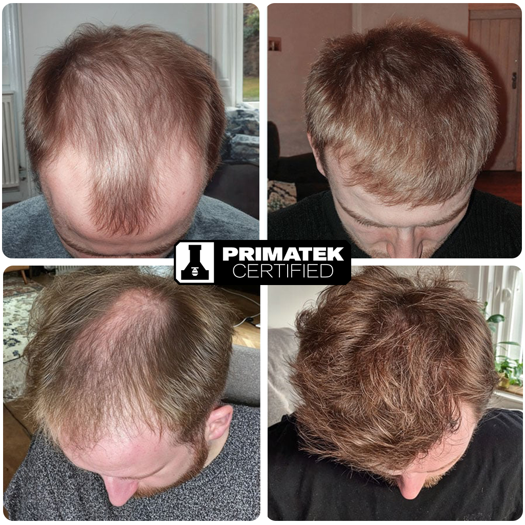 Système de Régénération Primatek Revolution™